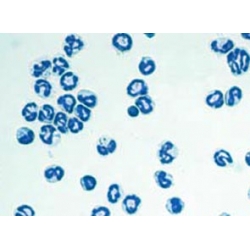 C57BL/6 Mouse Bone Marrow Neutrophils