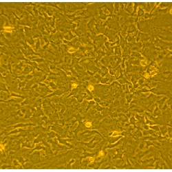 C57BL/6 Mouse Bone Marrow Mesenchymal Stem Cells (B6MSC)