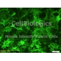 BKS db Control Mouse Coronary Artery Smooth Muscle Cells