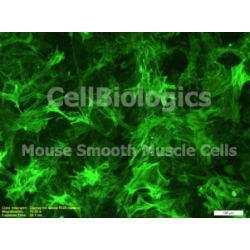 Human Primary Bladder Smooth Muscle Cells