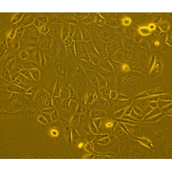 Human Primary Small Intestinal Epithelial Cells
