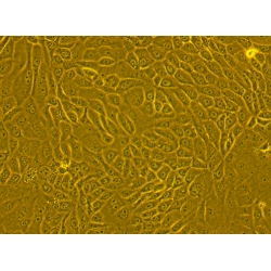 Human Primary Diabetic Alveolar Epithelial Cells (HDALEP)