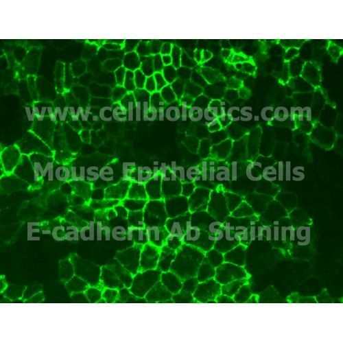 Human Primary Bladder Smooth Muscle Cells supplier